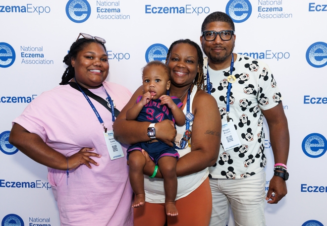 Black family with young child posing for picture at Eczema Expo